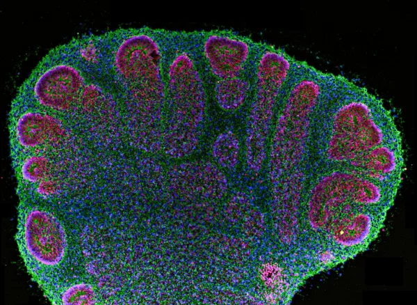 Two month old cerebral organoid